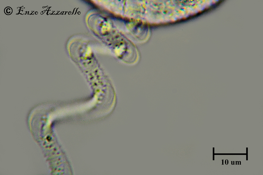 QUESTE FOTO MI PIACCIONO TROPPO! MIONEMA DI VORTICELLA 1000X